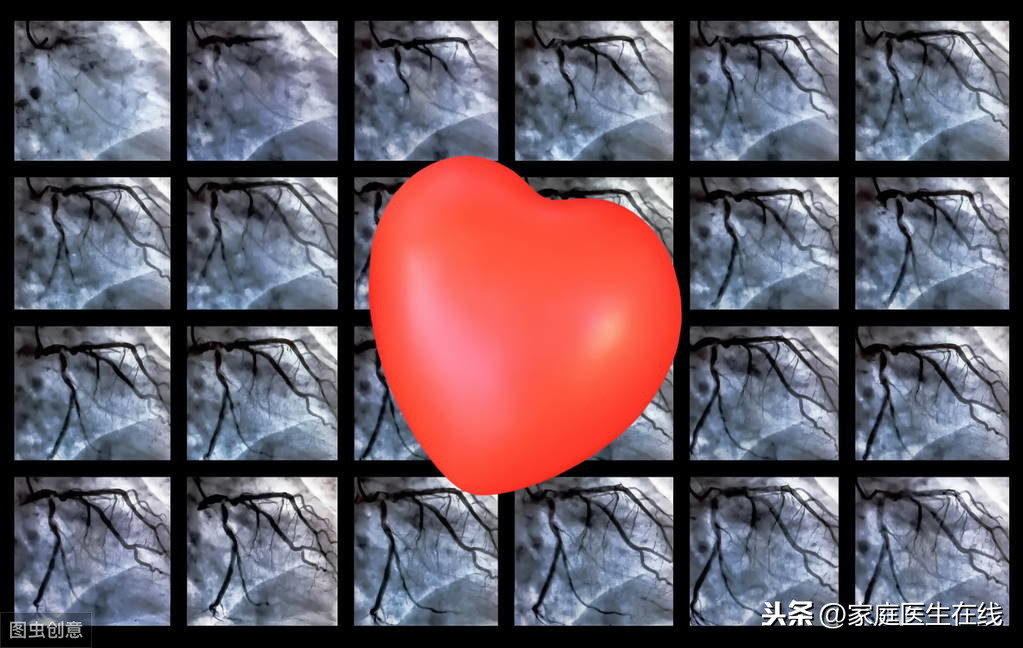 心脏造影能查出心脏疾病吗？3个作用，是检查心脏的好选择