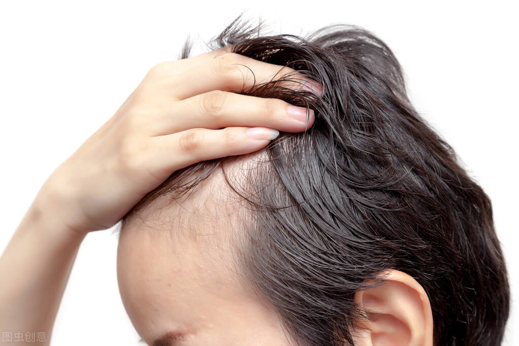 这10个原因会导致脱发，中医内服外用减少掉发