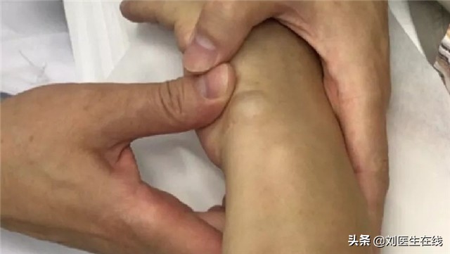 腱鞘炎是怎么产生的，为什么女性容易遭其折磨，该咋办？