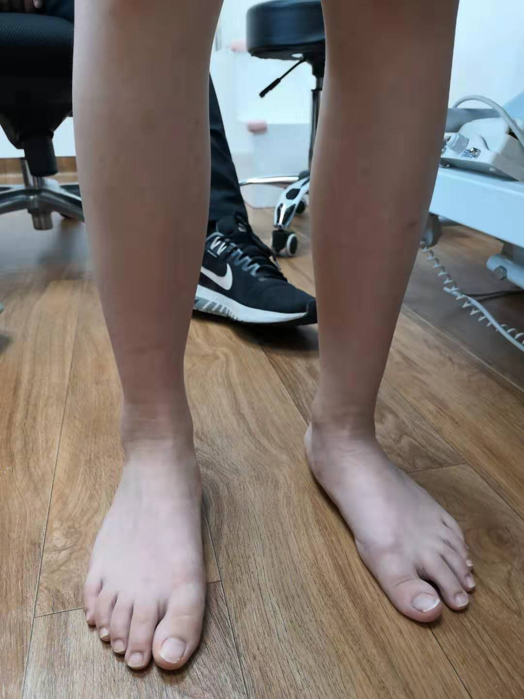 什么是扁平足图片(扁平足) - 赤虎壹号