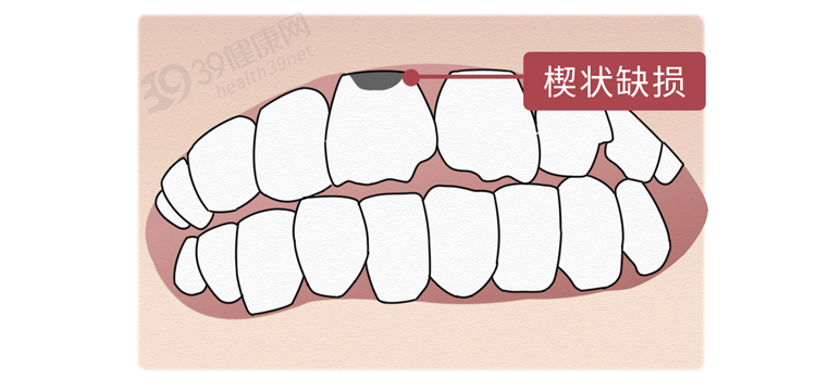 磨牙是什么原因引起的（导致磨牙的根本原因和解决方法）