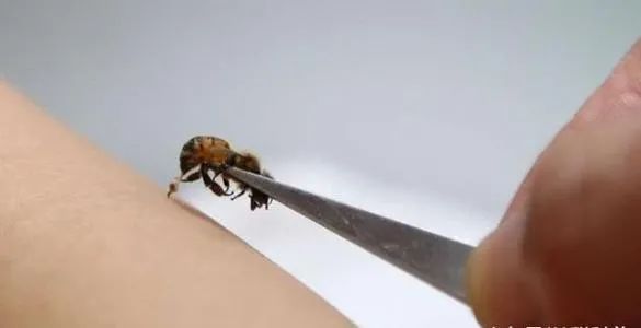 3岁女童擦伤却被截肢！只因家长这样包扎……