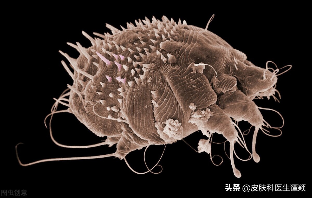 皮肤科医生和你聊聊：疥疮能通过什么途径传染？