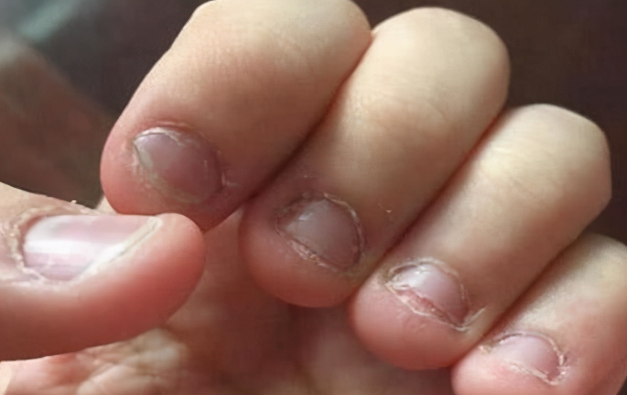 三个好处不为人知,宝妈别急着制止