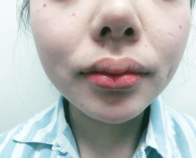 如何分辨自己的唇形(公认最好看的五种唇形)_http://damaozi.