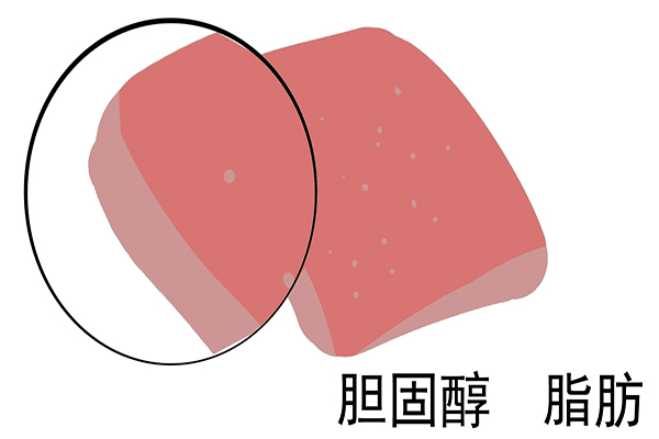 吃猪血排黑便，说明它能排毒？对身体究竟好不好？不少人理解错了