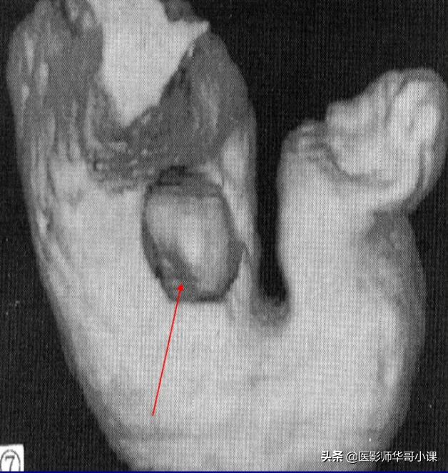 胃，3D立体重建技术，还您一个实实在在的胃。网友：价格多少呢