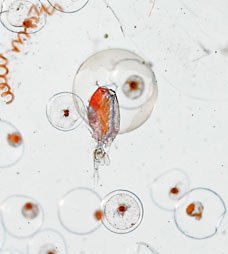 奇趣照片：显微镜下的一滴海水及一滴眼泪