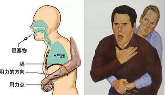 宝宝噎住了怎么办？父母都该学学这招急救法，危急时也许能救命
