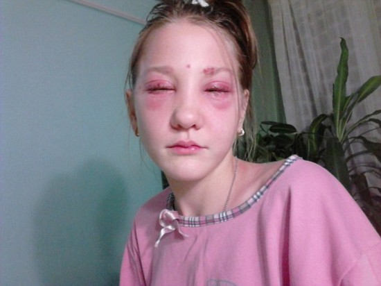 种睫毛的风险有多高?不少人做过都后悔了,业内人士说出实情