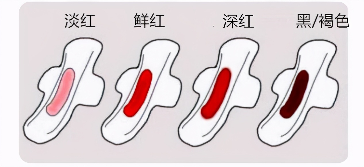 为什么月经是黑色的 宫颈癌褐色分泌物图片-诚智百科网