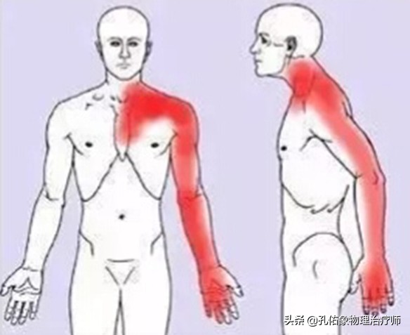 常手麻、手痛，究竟是哪里的问题？不出意外，这5种可能性最大
