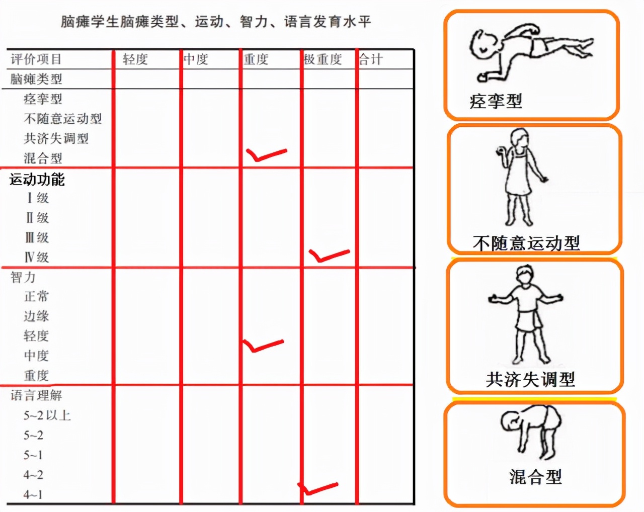 脑瘫宝宝康复案例，这个超过百万播放的视频，一定会让你泪目