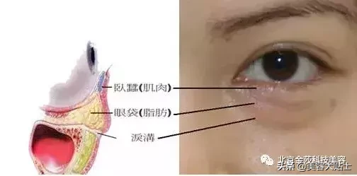 眼袋和卧蚕傻傻分不清楚？两分钟让你明白！