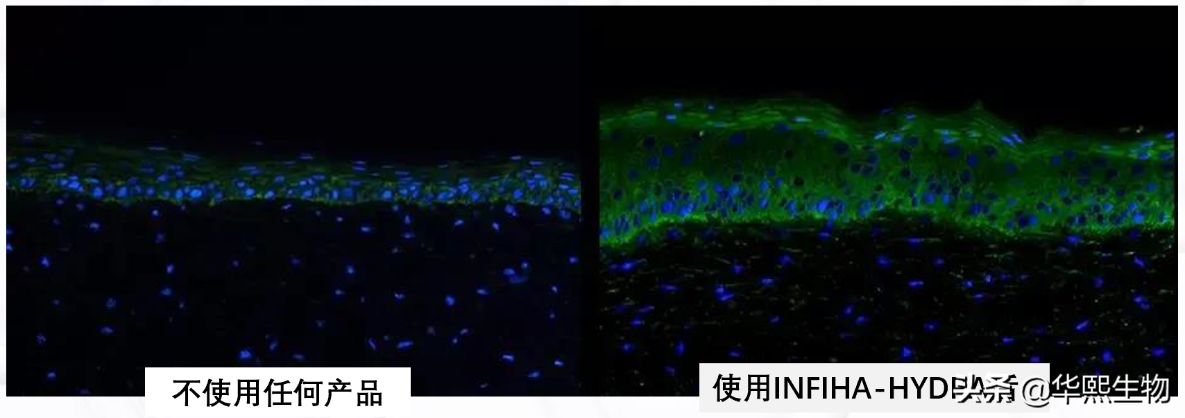 华熙生物玻尿酸技术再突破 润百颜次抛从外补到促内生