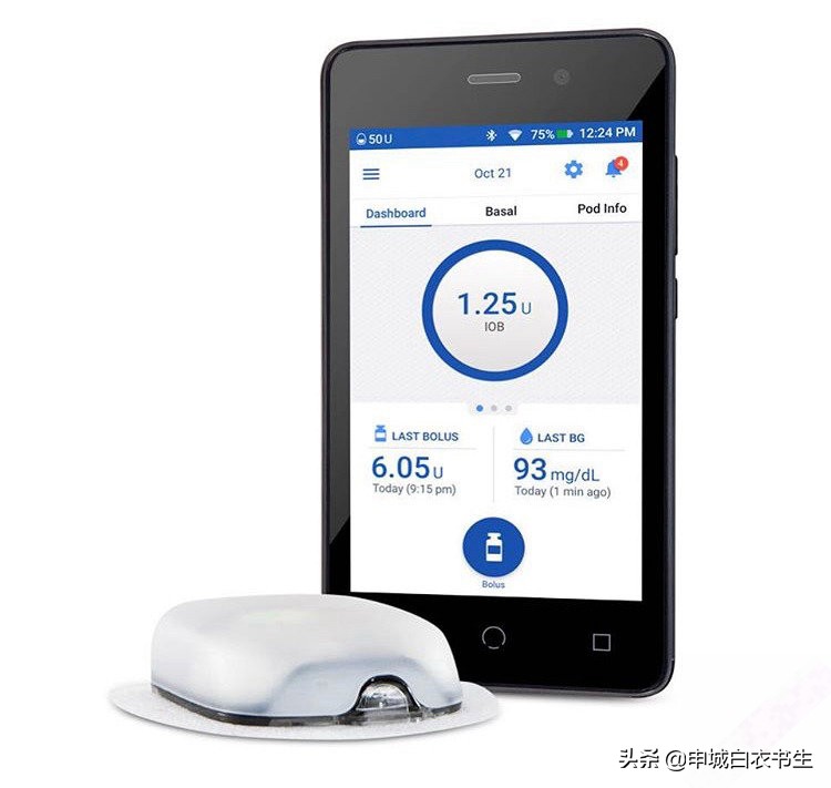 3万元左右，糖尿病患者，可以接受的胰岛素泵有哪些？
