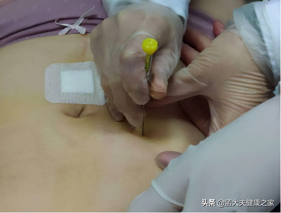 降脂必看，得了高血脂症和动脉粥样硬化，该怎么办？