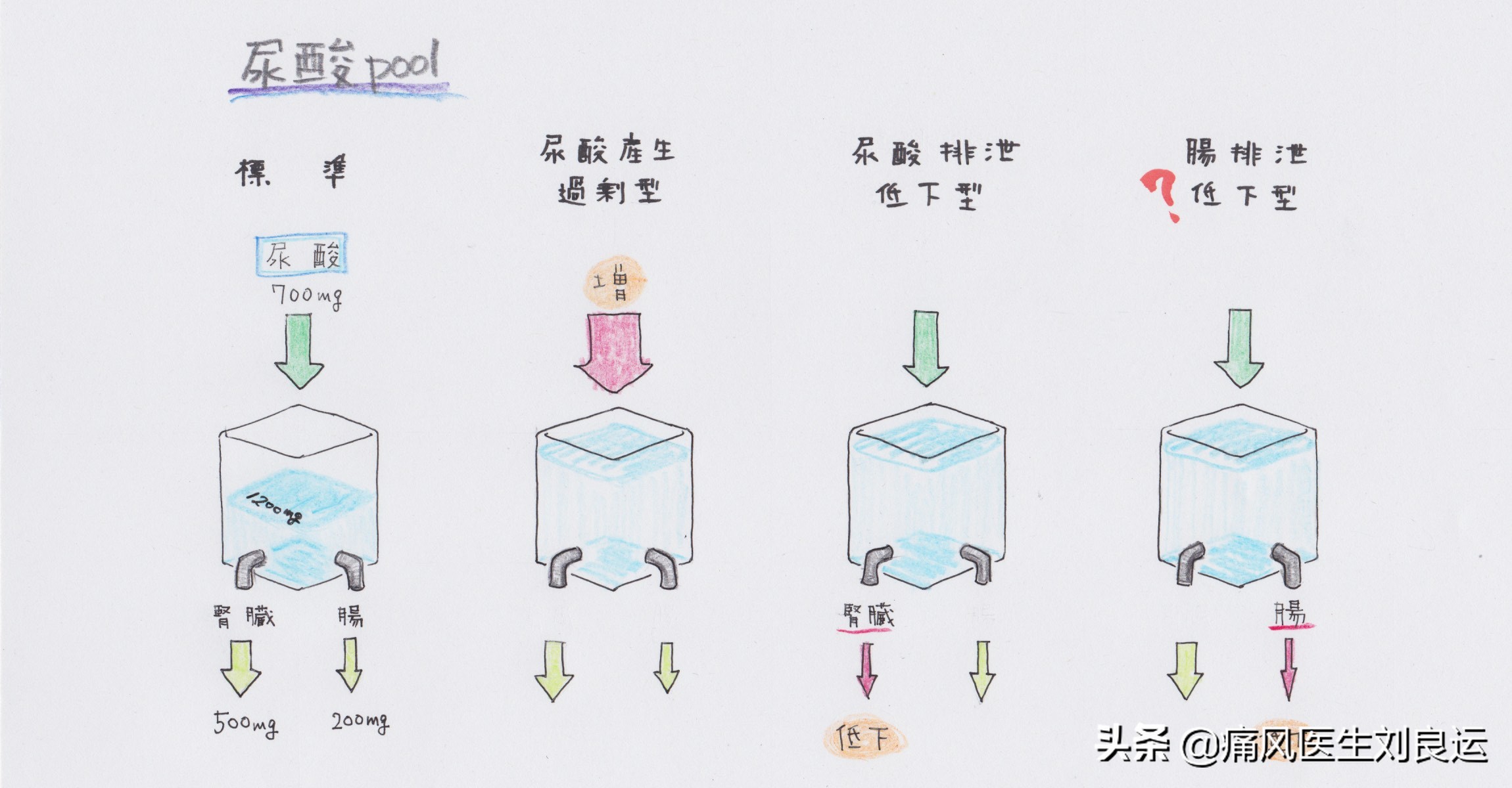 痛风患者双手长痛风石，儿媳不让他抱孙子？自行用药治痛风有风险