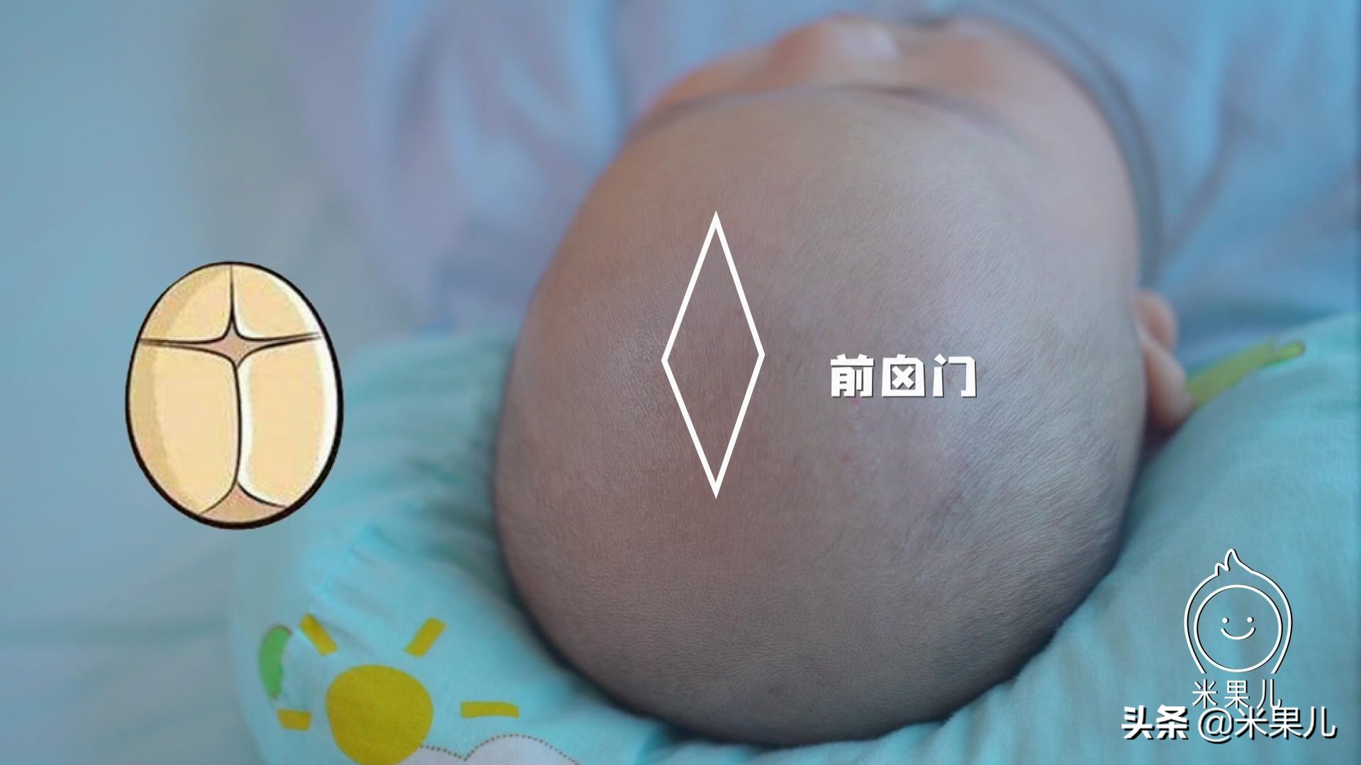 婴儿的囟门(宝宝的囟门能不能摸) - 乐宝宝贝