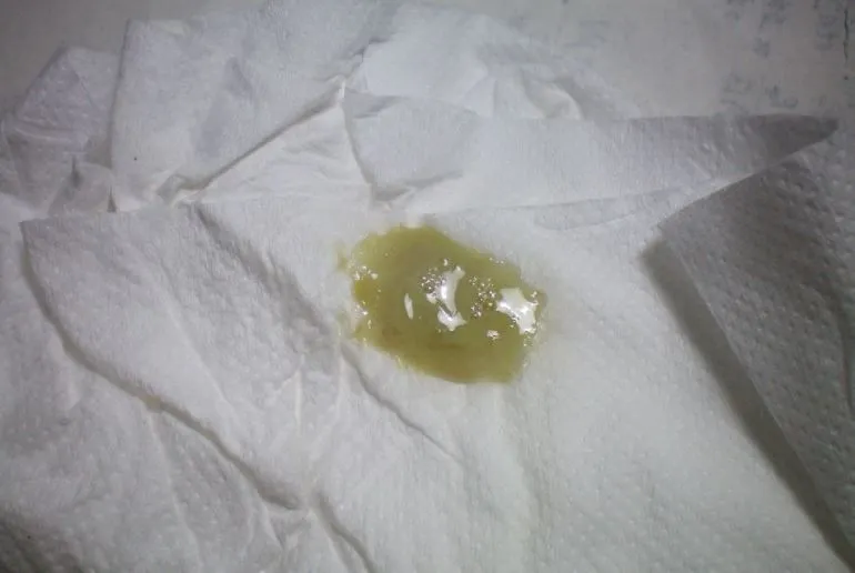 私处分泌物的6种变化,出现这3种颜色赶紧和他一起就医