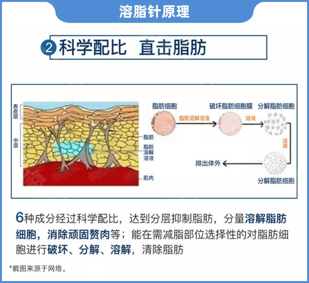 美白针、溶脂针是国家违禁项目,注意避坑