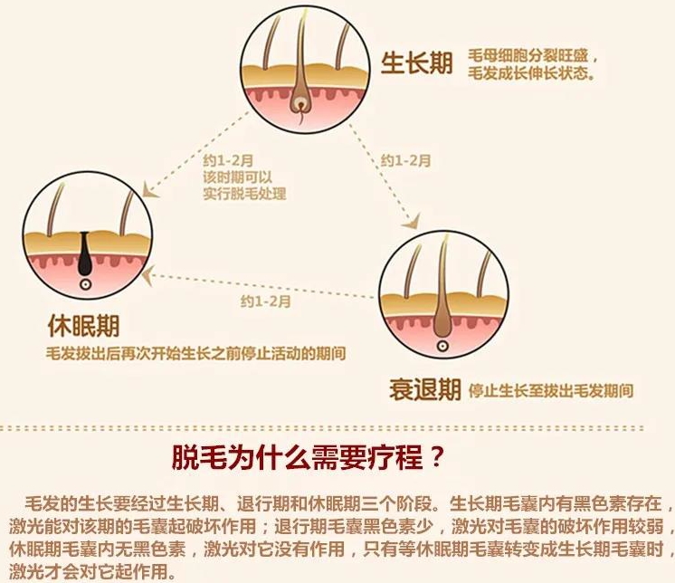 关于激光脱毛，你想了解的，都在这里