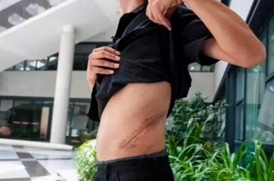 10年前，卖肾买苹果手机的少年，获赔147万后，生活却过得很难堪