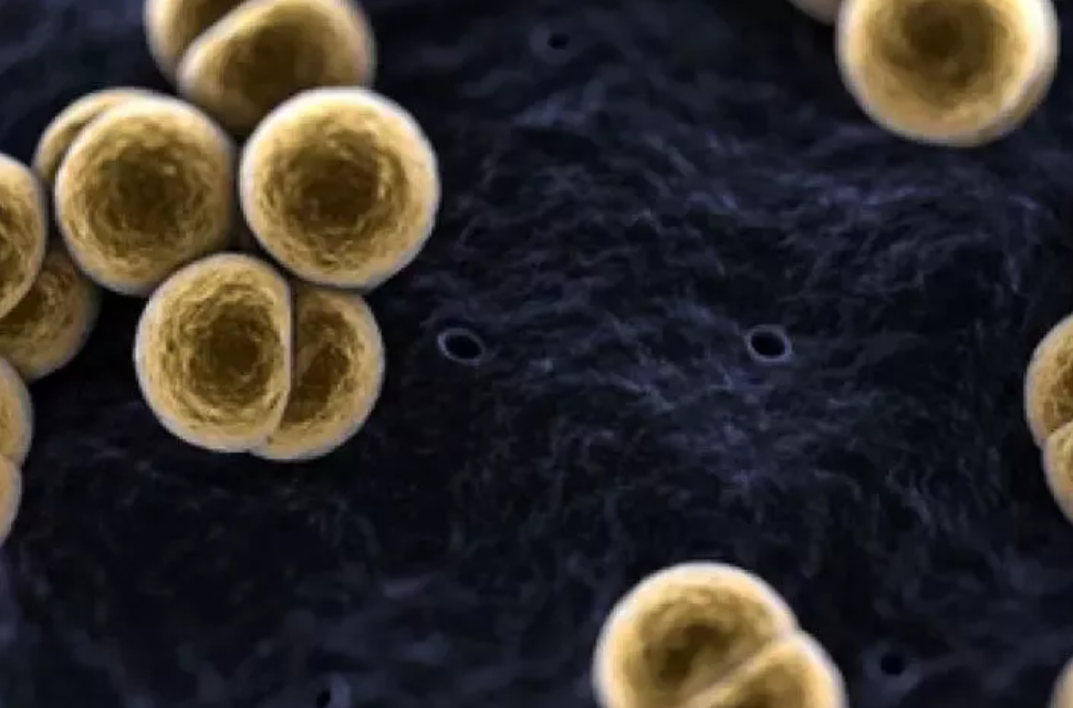 25岁女子泡澡感染致病细菌！医生：不得不截肢