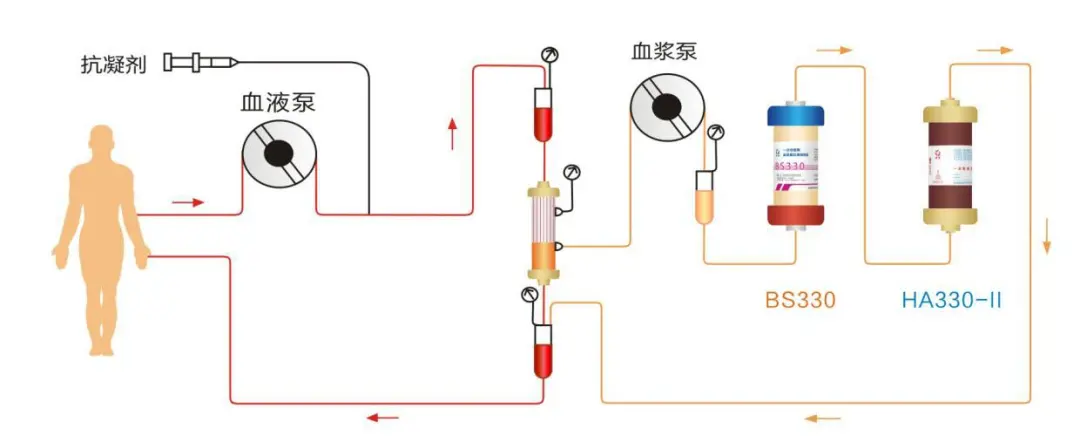 因被蚊子叮、吃凉西瓜住进ICU，大兴医院这项人工救命技术绝了