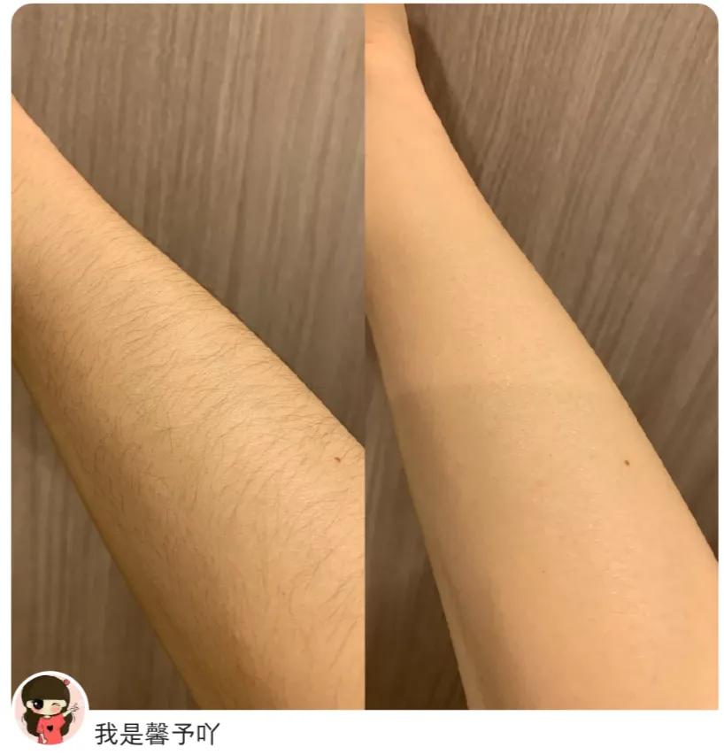 每個人的身上都有毛毛，我們一起脫毛毛