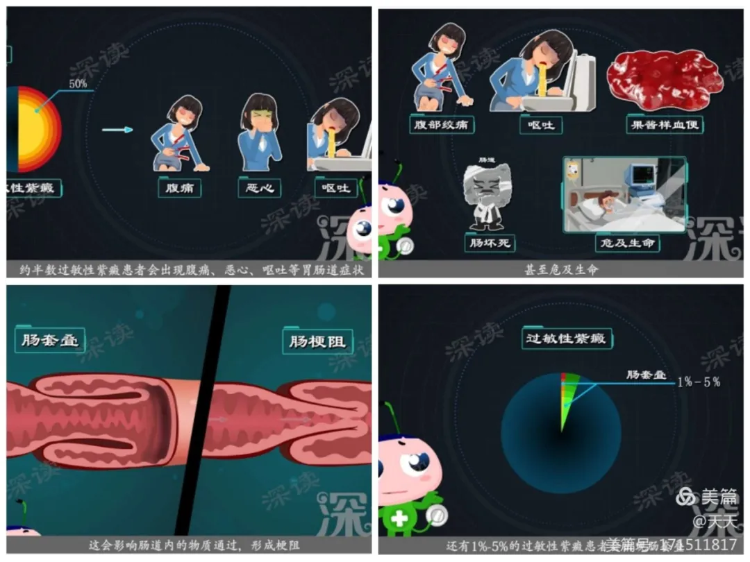 你知道过敏性紫癜吗？别急，看渭南市中医医院为您科普