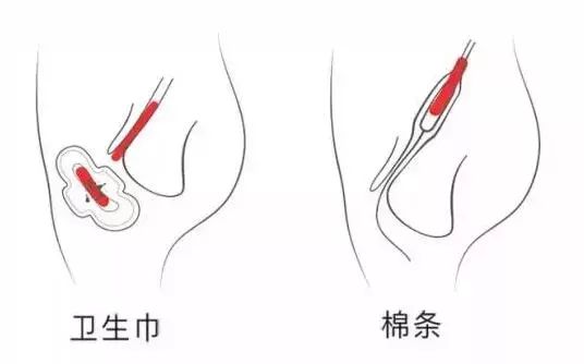 卫生棉条进入的感觉图片