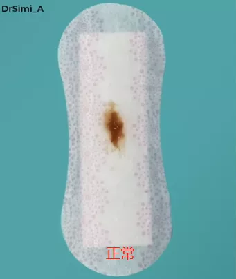 私处分泌物的6种变化,出现这3种颜色赶紧和他一起就医