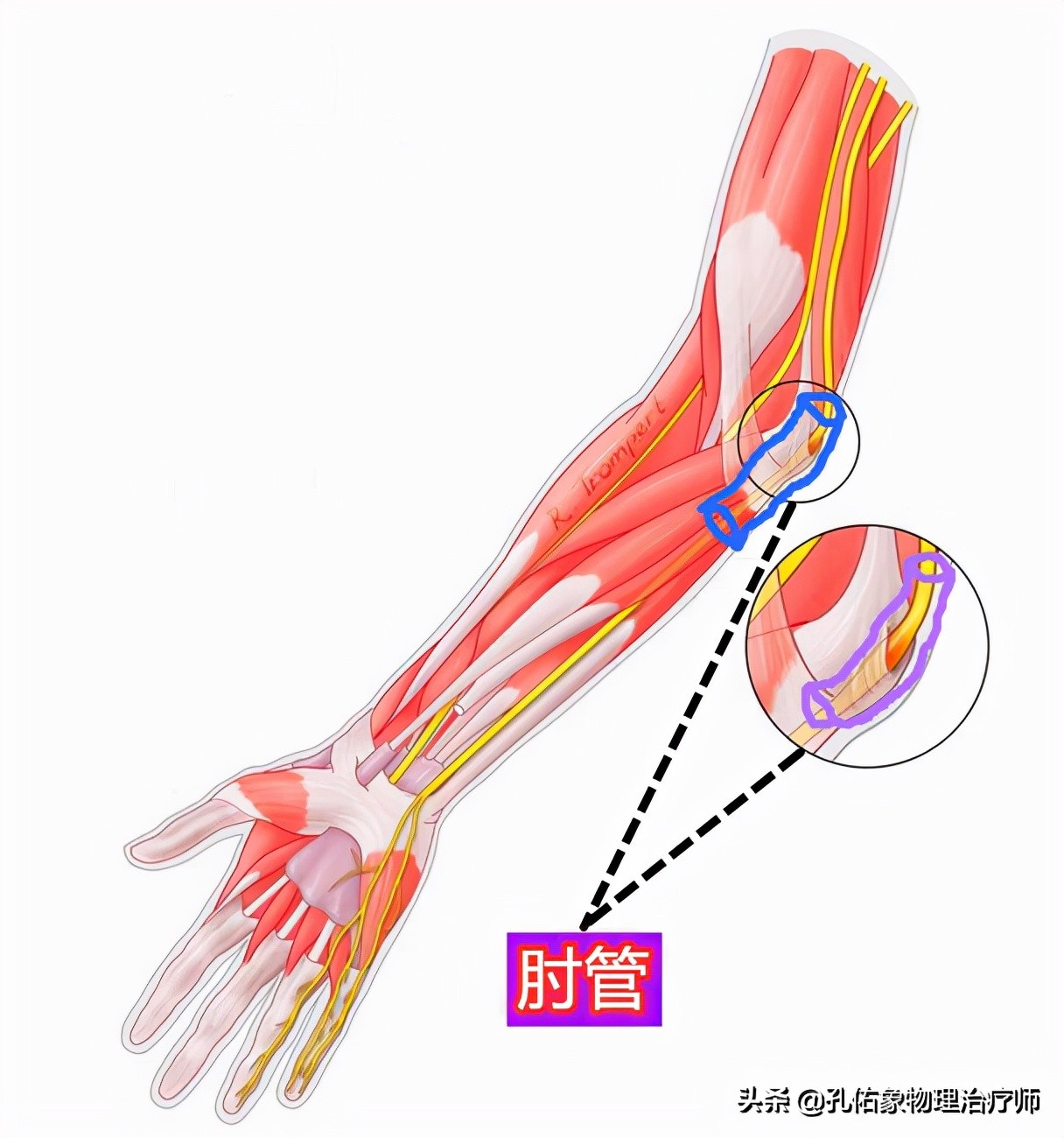 常手麻、手痛，究竟是哪里的问题？不出意外，这5种可能性最大