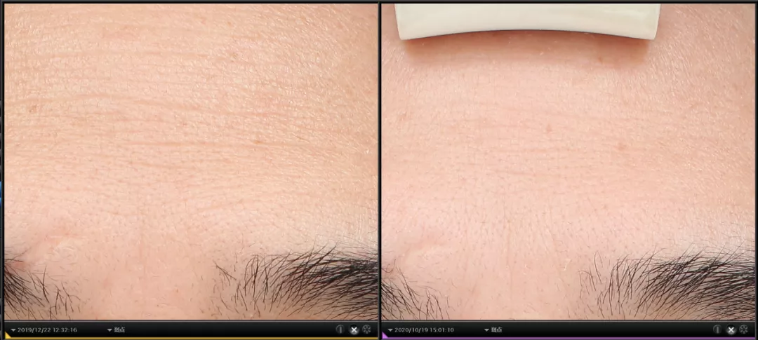 抗衰产品大起底,这 10 款性价比超高,不比医美差