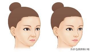 法令纹原来是这么来的！还得这样拯救，赶紧得