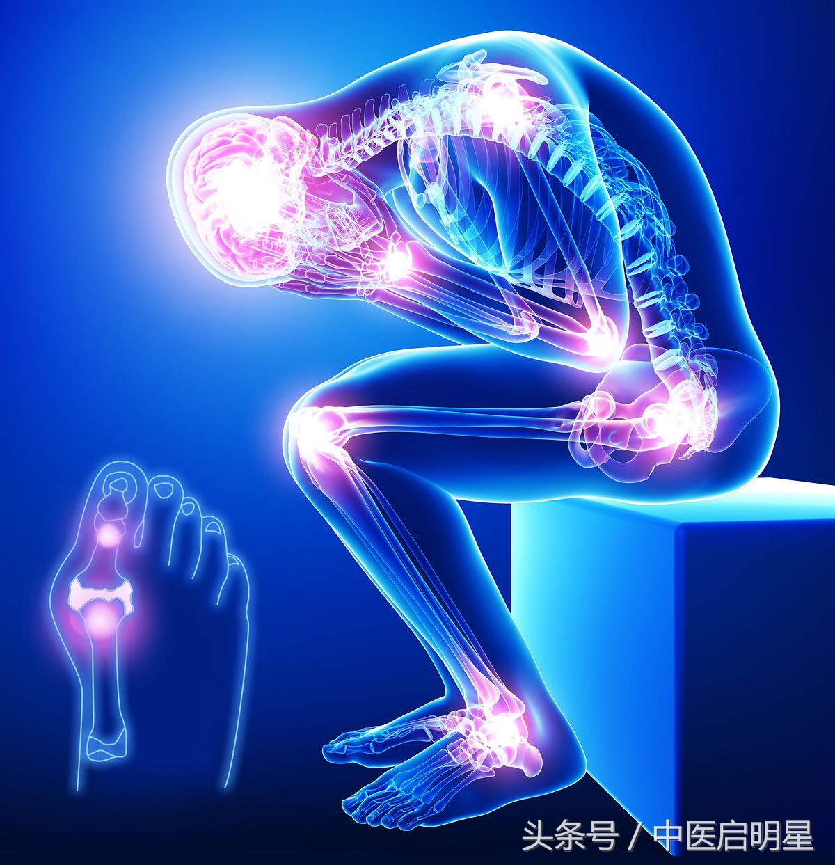 关节炎,风湿性关节炎和类风湿性关节炎等等这类毛病,中医称为"痹症"