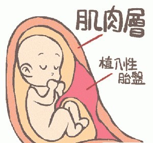 人工流产的危害，妇科医生一次性讲清，比你想的严重多了！