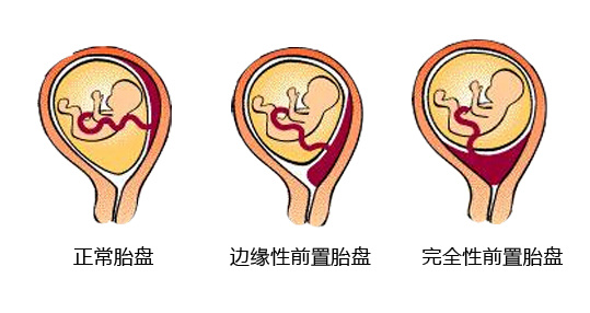 人工流产的危害，妇科医生一次性讲清，比你想的严重多了！