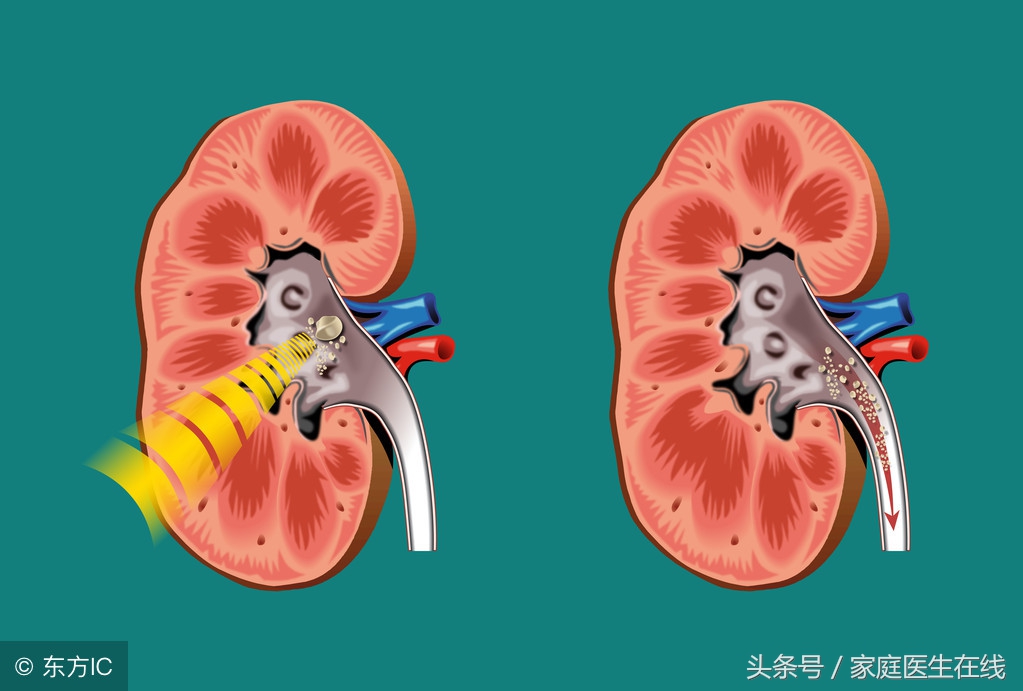 如何避免CT检查对儿童的损伤？医生站出来为我们答疑