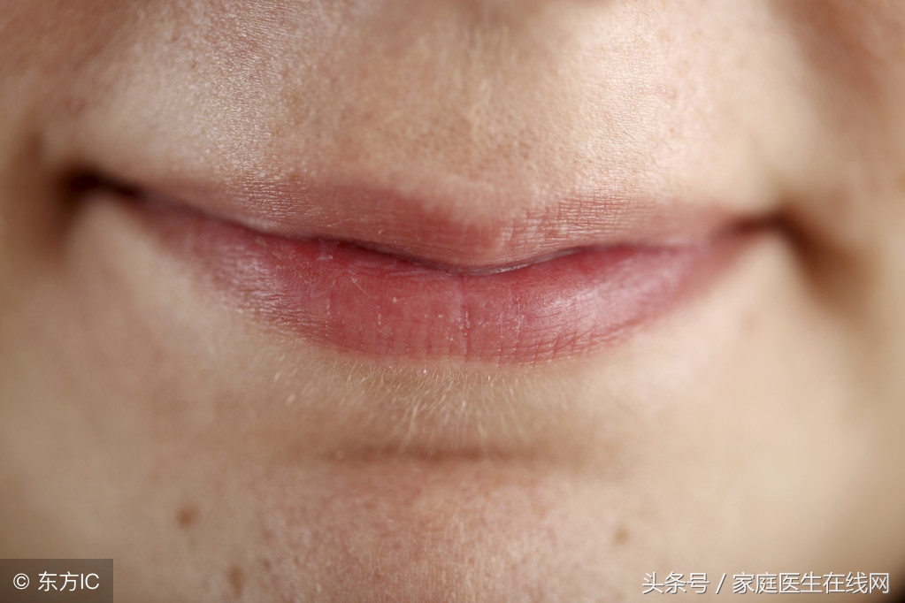 嘴唇上长泡怎么办？快速缓解唇部水泡的有效方法与日常护理建议