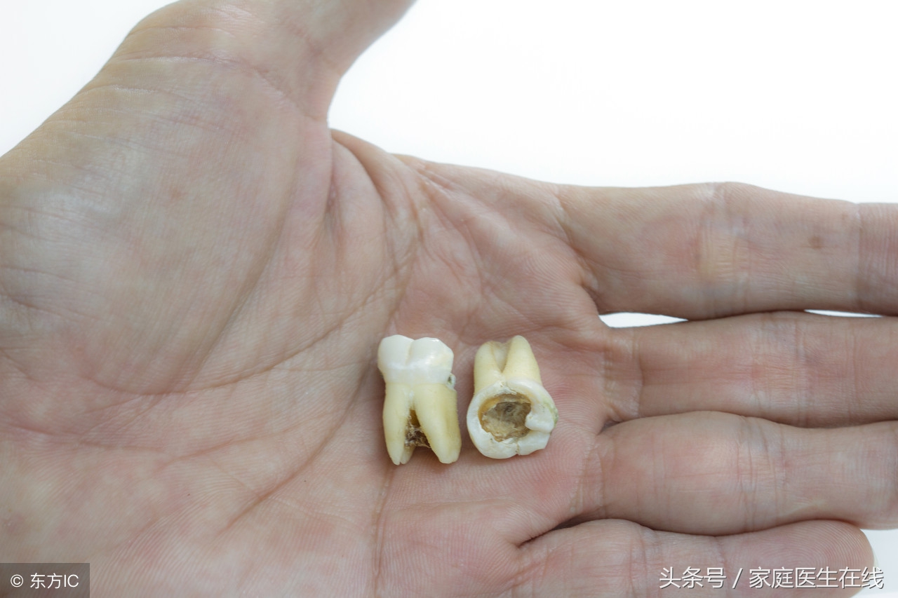孕妇牙疼怎么办？得分这三种情况，对症下药