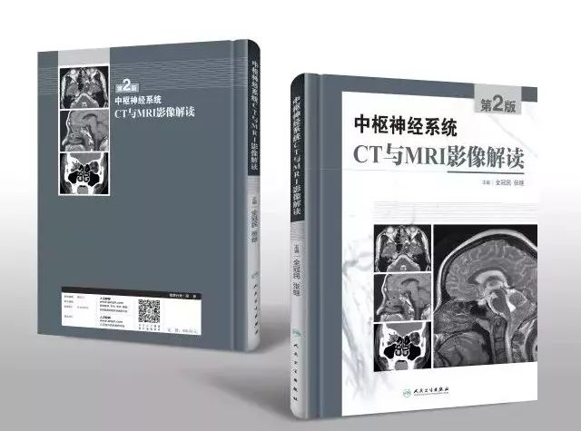 中枢神经系统CT与MRI影像解读，你掌握了吗？