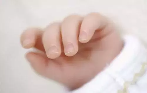 宝宝指甲透露出健康状况!长倒刺、有凹痕要警惕这些病!