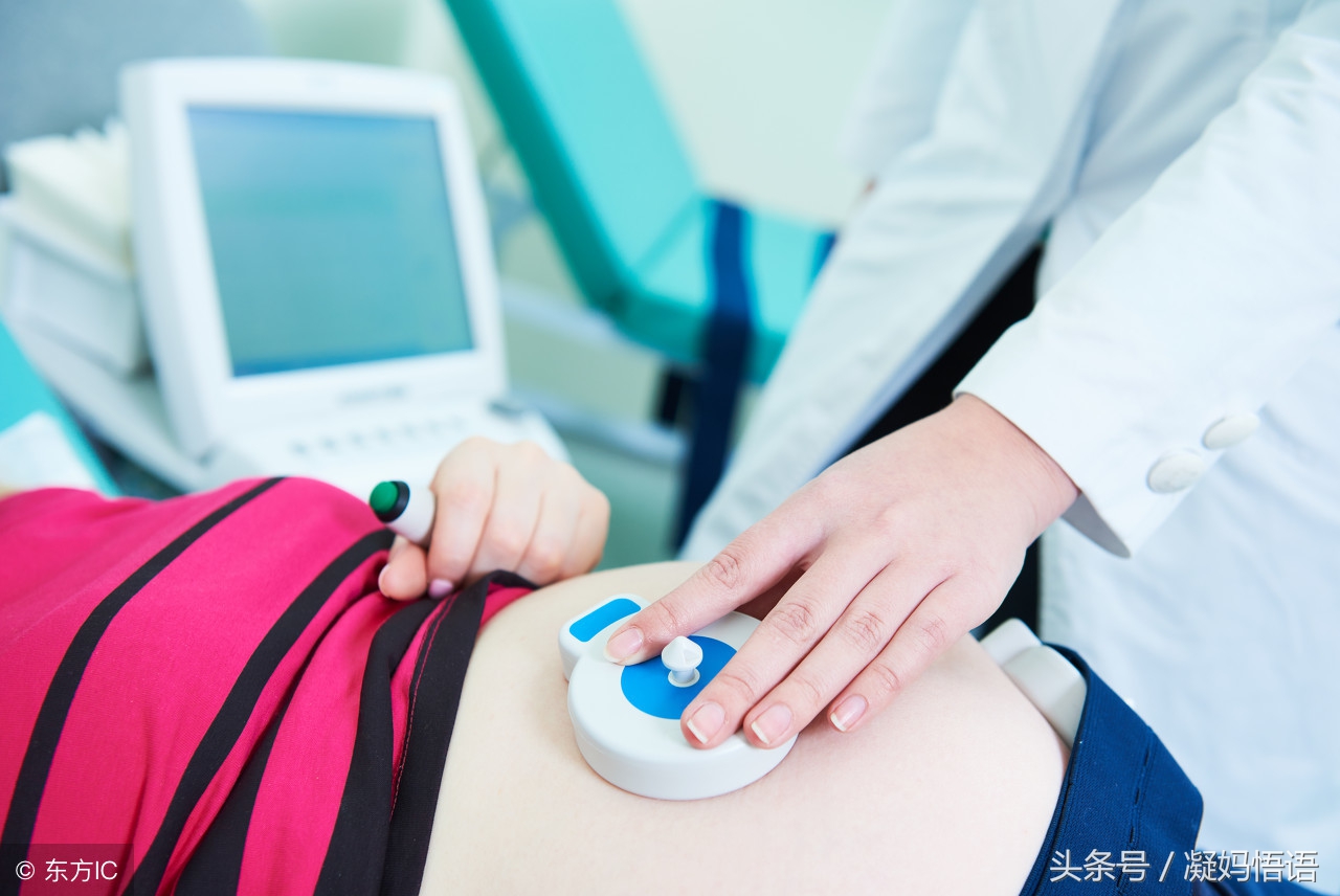胎心监护多次不过关，宝宝不动如何应对？