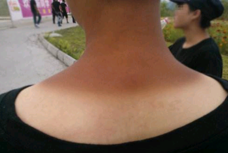 或者是出门旅游,但是外面太阳很大,很容易会被晒黑,尤其是我们手臂