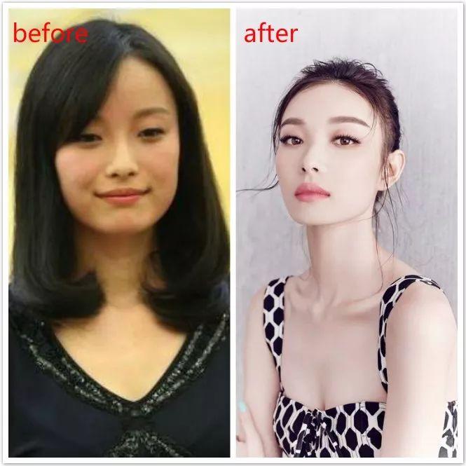 评测：400元玉兰油的美白功效 竟和1500元的小灯泡一样显著？