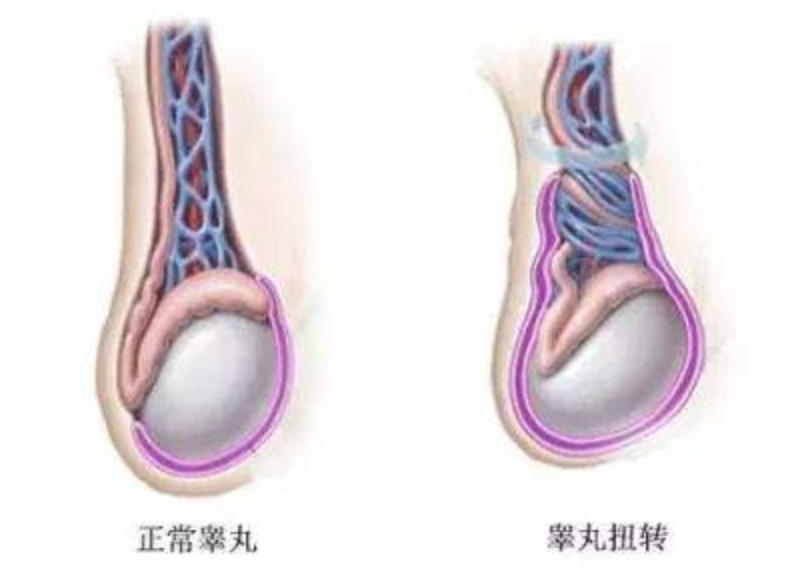 男生睡觉时“蛋疼”，到医院一看：“蛋蛋”发黑险些保不住