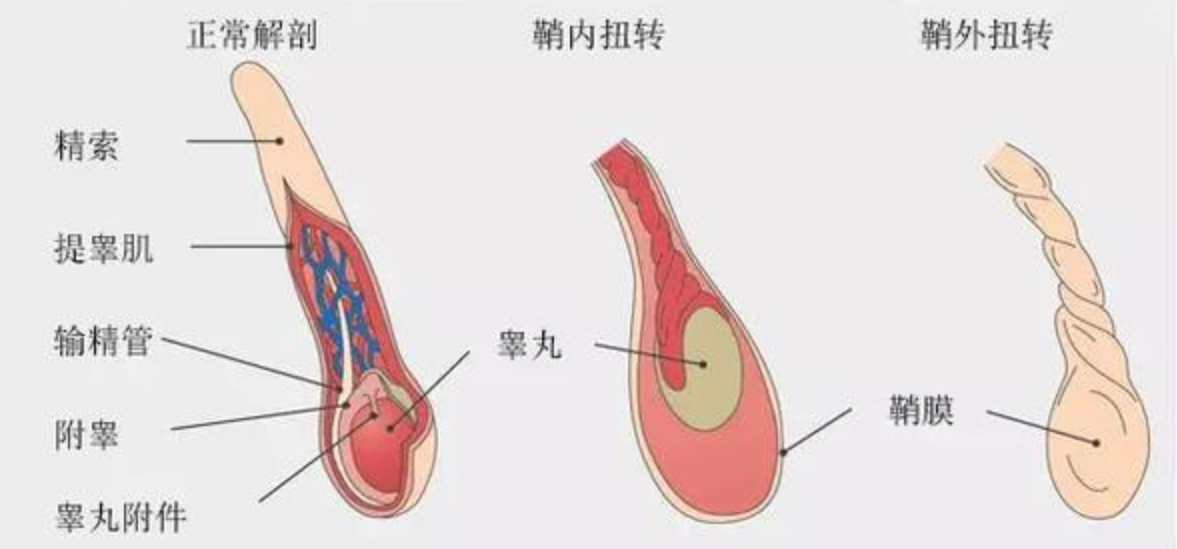 男生睡觉时“蛋疼”，到医院一看：“蛋蛋”发黑险些保不住