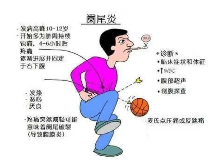 小痛小病莫轻视！阑尾炎的小阵痛拖久了可致命